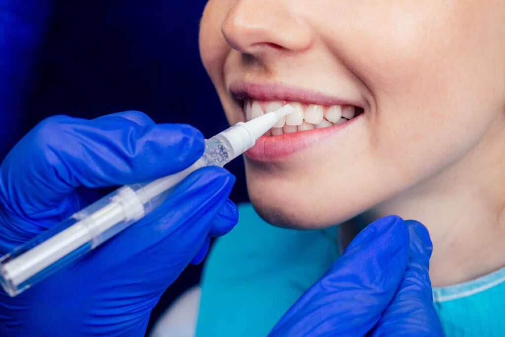 04 A dentist applying a gel product to the teeth of a smiling young woman.