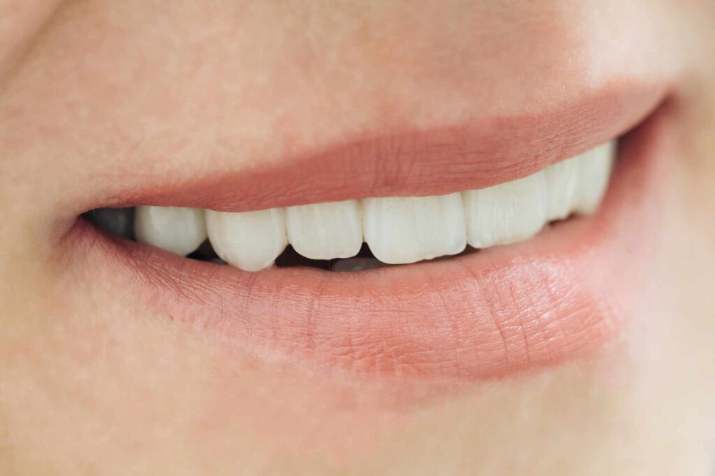 07 Female mouth showing zirconia dental veneers almost identical to the natural enamel