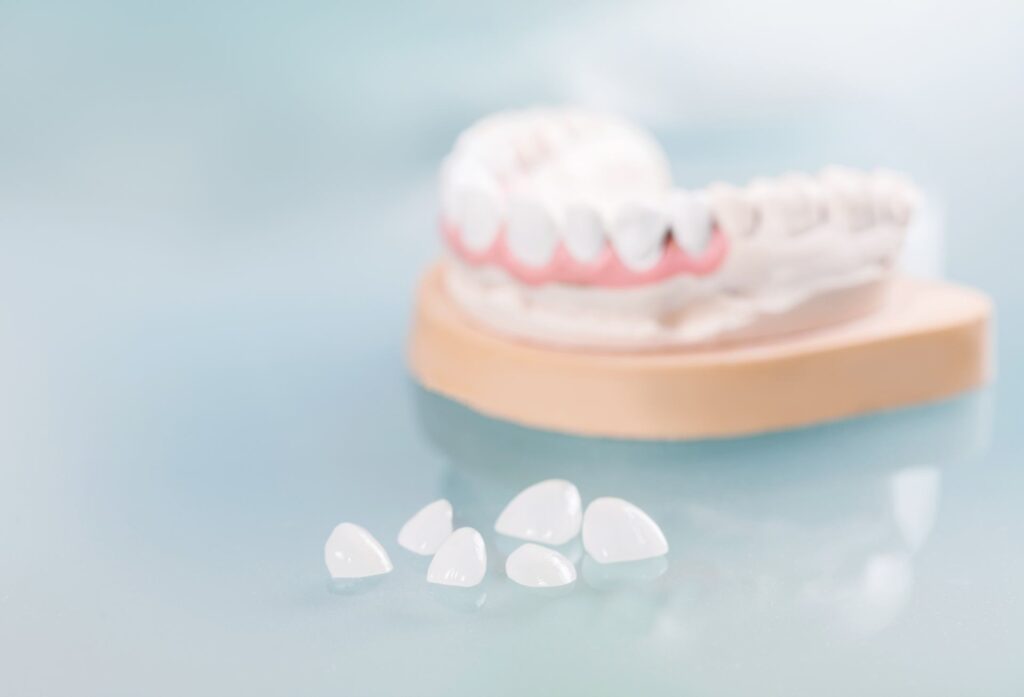 05 Porcelain veneers on a glass table next to a mock-up of human jaws_Lumineers vs. porcelain veneers