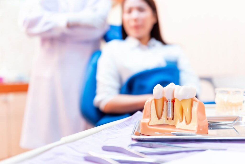 04 Sectional side view of the mock-up of a metal dental implant with dentist and patient out of focus in the background_Types of dental implants