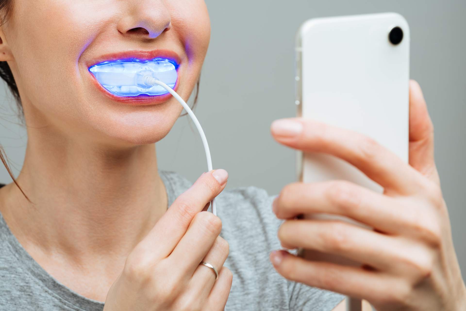 A young woman having her teeth whitened at home with UV light, splint or tray_tooth