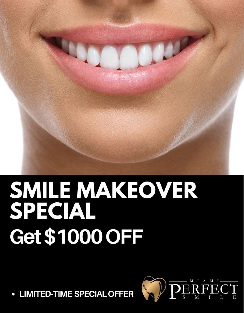 Veneers special Miami Perfect Smile
