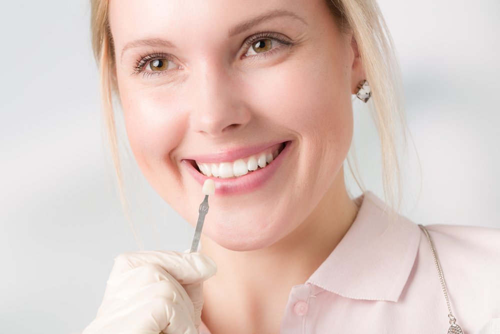 Finding Affordable Veneers in Connecticut